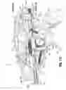 Fig. 78 - Flexible endoscopic stitching devices