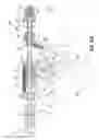 Fig. 85 - Flexible endoscopic stitching devices