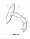 Fig. 88 - Flexible endoscopic stitching devices