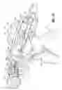 Fig. 93 - Flexible endoscopic stitching devices