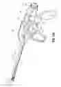 Fig. 95 - Flexible endoscopic stitching devices