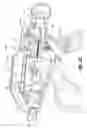 Fig. 99 - Flexible endoscopic stitching devices