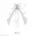 Fig. 14 - Suturing devices and methods for suturing an anatomic valve