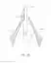 Fig. 21 - Suturing devices and methods for suturing an anatomic valve