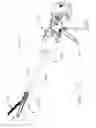 Fig. 65 - Surgical instrument with an anvil that is selectively movable about a discrete non-movable axis relative to a staple cartridge