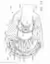 Fig. 14 - Drive arrangements for articulatable surgical instruments