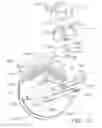 Fig. 17 - Drive arrangements for articulatable surgical instruments