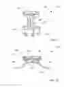 Fig. 11 - SURGICAL FASTENERS AND FASTENING DEVICES
