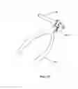 Fig. 28 - SURGICAL FASTENERS AND FASTENING DEVICES