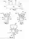 Fig. 03 - ANASTOMOSIS DEVICES AND METHODS OF USING SAME