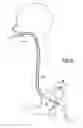 Fig. 05 - Anastomotic device for joining lumens or viscera to each other