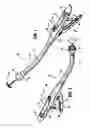 Fig. 02 - Surgical stapling device for performing circular anastomoses