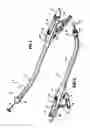 Fig. 04 - Surgical stapling device for performing circular anastomoses
