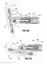 Fig. 52 - Surgical stapling device for performing circular anastomoses