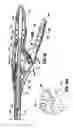 Fig. 71 - Surgical stapling device for performing circular anastomoses