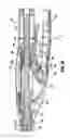 Fig. 80 - Surgical stapling device for performing circular anastomoses