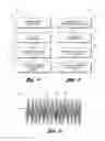Fig. 09 - Occluding device and method of occluding fluid flow through a body vessel
