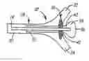 Fig. 01 - METHODS AND DEVICES FOR THE TREATMENT OF ANEURYSMS