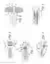 Fig. 03 - METHODS AND DEVICES FOR THE TREATMENT OF ANEURYSMS