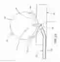 Fig. 13 - METHODS AND DEVICES FOR THE TREATMENT OF ANEURYSMS