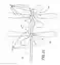 Fig. 16 - METHODS AND DEVICES FOR THE TREATMENT OF ANEURYSMS