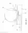 Fig. 20 - METHODS AND DEVICES FOR THE TREATMENT OF ANEURYSMS