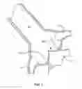 Fig. 02 - Method and system for balloon counterpulsation during aortic valve replacement