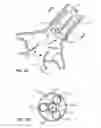 Fig. 04 - Method and system for balloon counterpulsation during aortic valve replacement