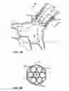Fig. 05 - Method and system for balloon counterpulsation during aortic valve replacement
