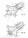 Fig. 07 - Method and system for balloon counterpulsation during aortic valve replacement