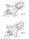 Fig. 08 - Method and system for balloon counterpulsation during aortic valve replacement