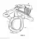 Fig. 03 - Patient-specific cutting guide for the shoulder