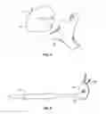 Fig. 06 - Patient-specific cutting guide for the shoulder