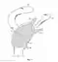 Fig. 07 - Patient-specific cutting guide for the shoulder