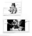 Fig. 05 - Device and method for fitting an artificial knee joint using universal electronic templates which can be adapted to all artificial joints