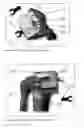 Fig. 09 - Device and method for fitting an artificial knee joint using universal electronic templates which can be adapted to all artificial joints