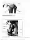 Fig. 10 - Device and method for fitting an artificial knee joint using universal electronic templates which can be adapted to all artificial joints