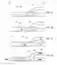 Fig. 09 - Post-conditioning suction catheter apparatus and methods