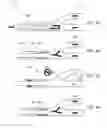 Fig. 10 - Post-conditioning suction catheter apparatus and methods