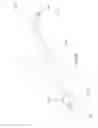 Fig. 17 - Post-conditioning suction catheter apparatus and methods