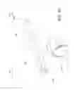 Fig. 21 - Post-conditioning suction catheter apparatus and methods