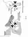 Fig. 03 - Semiconductor tweezers and instrumentation for tissue detection and characterization