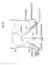 Fig. 29 - Endoscopic surgical device and overtube