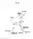 Fig. 33 - Endoscopic surgical device and overtube