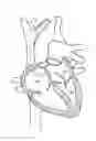 Fig. 01 - Methods and devices for puncturing tissue