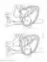 Fig. 24 - Methods and devices for puncturing tissue
