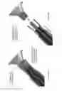 Fig. 25 - ARTIFICIAL INSEMINATION