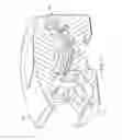 Fig. 09 - External fixation clamp using a trigger mechanism and stored spring energy