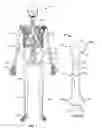 Fig. 02 - Apparatus and methods for bone repair preparation
