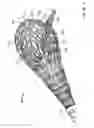 Fig. 05 - Apparatus and methods for bone repair preparation